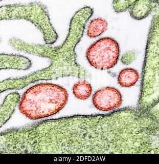 Kolorierte Transmissionselektronenmikrographie von reifen extrazellulären Nipah-Virus-Partikeln (rot) nahe der Peripherie einer infizierten VERO-Zelle (grün). Im Stockfoto