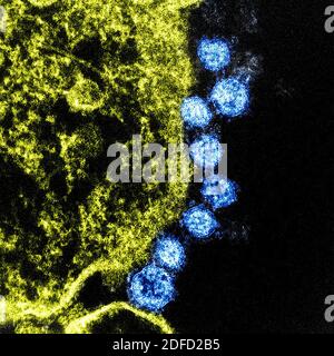 Kolorierte Transmissionselektronenmikrographie des Middle East Respiratory Syndrome Virus Partikel (blau) in der Nähe der Peripherie eines infizierten VERO gefunden E6 Stockfoto