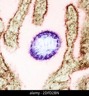 Kolorierte Transmissionselektronenmikrographie eines reifen extrazellulären Nipah-Virus Partikel (violett) in der Nähe der Peripherie einer infizierten VERO-Zelle (Braun) Stockfoto
