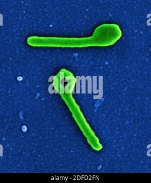 Koloriertes Rasterelektronenmikrograph von zwei Ebola-Viruspartikeln, die im extrazellulären Raum zwischen infizierten afrikanischen grünen Affen-Nierenzellen gefunden wurden. C Stockfoto