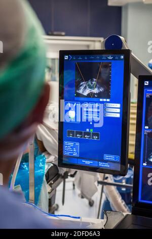 Behandlung von Prostatakrebs durch hochintensiven Fokus-Ultraschall (Focal-One), Bordeaux Krankenhaus, Frankreich. Stockfoto