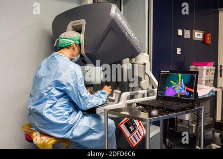 Bildgeführte robotische konservative Nierenchirurgie unterstützt durch 3D-Modellierung, Diese 3D-Modellierung der Niere mit seinem Tumor in lila befindet, führt die s Stockfoto