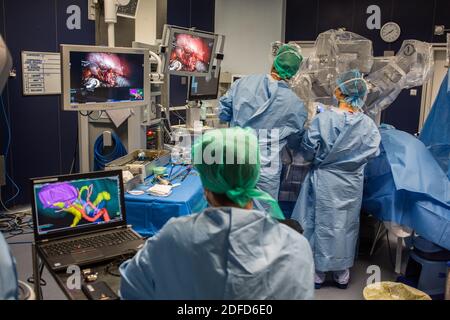 Bildgeführte robotische konservative Nierenchirurgie unterstützt durch 3D-Modellierung, Diese 3D-Modellierung der Niere mit seinem Tumor in lila befindet, führt die s Stockfoto