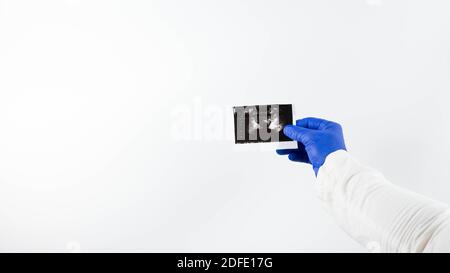 Ultraschall der Prostata in den Händen eines Arztes Stockfoto