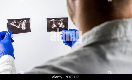 Der Arzt untersucht die Ultraschallbilder der Prostata, Prostata-Bilder in den Händen eines Arztes, auf weißem Hintergrund. Stockfoto