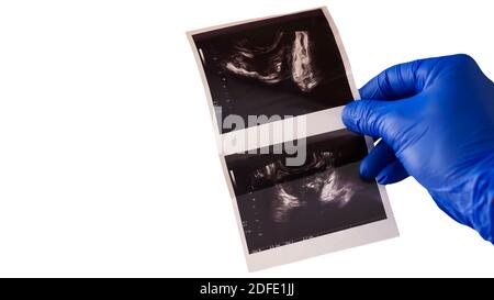 Transrektaler Ultraschall der Prostata.der Arzt untersucht den Patienten mittels Röntgenaufnahme. Stockfoto