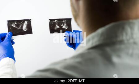 Ultraschall der Prostata in den Händen eines Arztes, um eine Diagnose zu stellen, Nahaufnahme Stockfoto