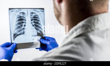 Ein Arzt hält eine Röntgenaufnahme der Lunge, eine Diagnose, ein Arzt macht einen Abschluss auf einer Röntgenaufnahme. Stockfoto