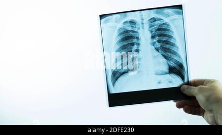 Ein Arzt zeigt eine Röntgenaufnahme der Lunge einer Person auf Ein weißer Hintergrund, ein Arzt hält eine Röntgenaufnahme in seinem Hände und diagnostiziert einen Patienten Stockfoto