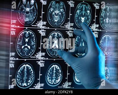 Neurologische Diagnose, konzeptuelles Bild Stockfoto