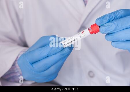 Labortechniker Hand hält Blutprobe Rohr Stockfoto