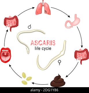 Ascaris. Lebenszyklus. Vektordarstellung der häufigsten menschlichen Nematodeninfektion. Würmer wachsen und Fortpflanzung im menschlichen Körper, und Produktion von Ei Stock Vektor