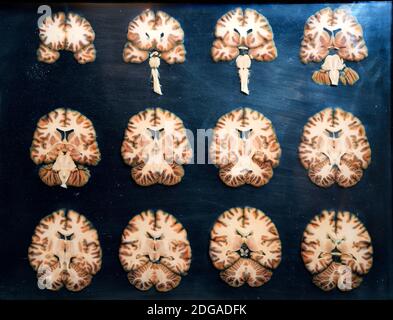 Präparat, Plastinat, Querschnitte durch das menschliche Gehirn, Lehrwerk Museum, Berlin, Deutschland Stockfoto