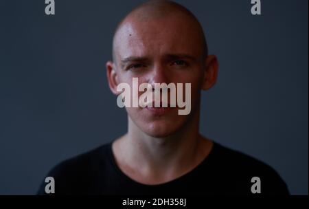 Ein Mann mit einem durchbohrten Kopf in einem schwarzen Pullover Emotionen Nahaufnahme dunklen Hintergrund Stockfoto