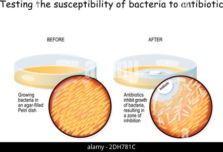 Testen der Anfälligkeit von Bakterien auf Antibiotika. Bakterien wachsen in einer Agar-gefüllten Petrischale. Experimentieren. Die DISK-Diffusion-Agar-Methode testet Stock Vektor