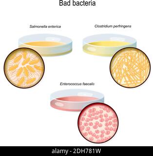 Eine Petrischale mit Bakterienkolonien. Darmflora. Nahaufnahme von schlechten Bakterien: Clostridium perfringens, Enterococcus fecalis und Salmonella enterica Stock Vektor