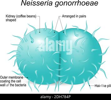 Neisseria gonorrhoeae (gonococcus) ist eine gram-negative Diplokokken Bakterien verursacht die Sexuell übertragbare Urogenitalinfektion - Gonorrhoe Stock Vektor