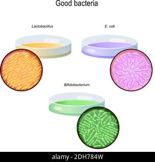 Eine Petrischale mit Bakterienkolonien. Darmflora. Nahaufnahme von guten Bakterien: Lactobacillus, Bifidobacterium longum, Escherichia coli. Vektordiagramm Stock Vektor