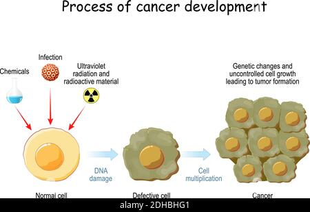 Prozess der Krebsentwicklung. Krebs verursachende Mittel und die Stadien der Umwandlung normaler Zelle zu defekter Zelle und Krebs. Genetische Veränderungen Stock Vektor