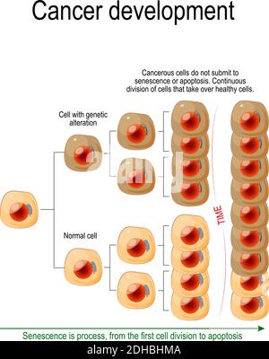 Krebsentwicklung. Krebszellen unterwerfen sich nicht einer Seneszenz oder Apoptose. Сontinuous Teilung von Zellen, die gesunde Zellen übernehmen. Vektor Stock Vektor