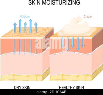 Feuchtigkeitsspendende Haut. Trockene und gesunde Haut mit Creme, Schaum oder Lotion. Vektor-Illustration für medizinische, Hautpflege, biologische, pädagogische, wissenschaftliche Nutzung Stock Vektor