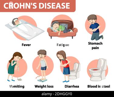 Medizinische Infografik zur Illustration der Morbus Crohn Stock Vektor