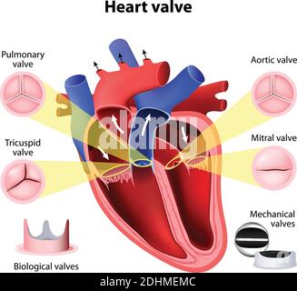 Herzklappenchirurgie. Lungen-, Tricuspid-, Aortenklappe und Mitralklappe. Biologische Ventile und mechanische Ventile Stock Vektor