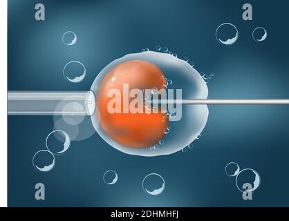 In-vitro-Fertilisation. IVF. Zelle unter dem Mikroskop. Menschliches Ei auf grauem Hintergrund. vektor. Illustration leicht editierbar für Ihre Hintergrundfarbe. Stock Vektor