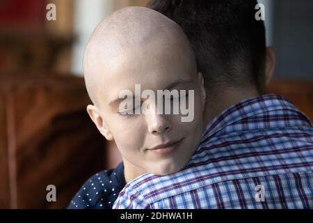 Close up krank haarlose Frau und liebevollen Mann umarmt Stockfoto