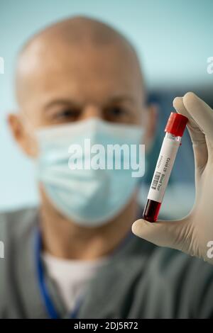 Handschaufel eines modernen Klinikers oder wissenschaftlichen Forschers Kleiner Kolben mit Probe kovidpositiven menschlichen Blutes Stockfoto