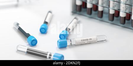 Tests auf Coronavirus Covid-19 in einem Labor. Medizinische Screening und Covid Tests Produktion. Stockfoto