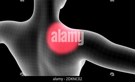 3d-Darstellung eines Frauen-Röntgenhologramms mit Schmerzbereich Auf der Rückseite Stockfoto