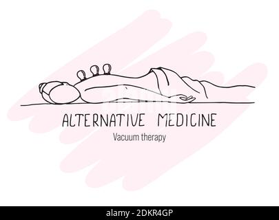 Das Mädchen befindet sich in einer Vakuumtherapie. Alternative Medizin. Doodle. Stock Vektor