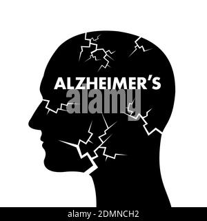 Alzheimer-Krankheit - Verschlechterung, Degeneration, Verfall und Verfall von Gehirn und Geist in den Kopf des Menschen und Menschen. Vektorgrafik Stockfoto