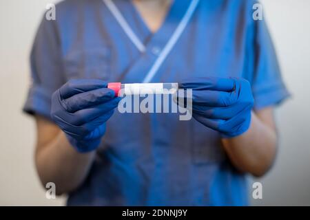 Wissenschaftler, der medizinische Proben im Reagenzglas hält Stockfoto
