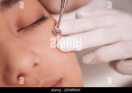 Nahaufnahme eines Dermatologen mit Schwarzkopfentferner, Reinigung Gesicht einer weiblichen Klientin Stockfoto