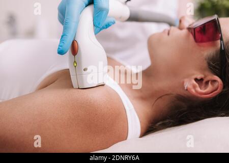 Frau geeting Körperhaar auf ihre Schulter im Schönheitssalon entfernt. Kosmetologe mit Laser-Haarentfernungsgerät auf einem weiblichen Kunden Stockfoto