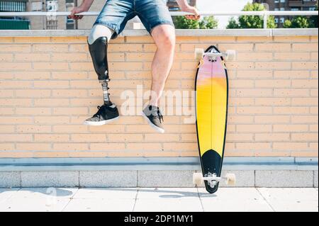 Junger Mann mit Bein Prothese sitzt auf Geländer in der Stadt neben Skateboard Stockfoto