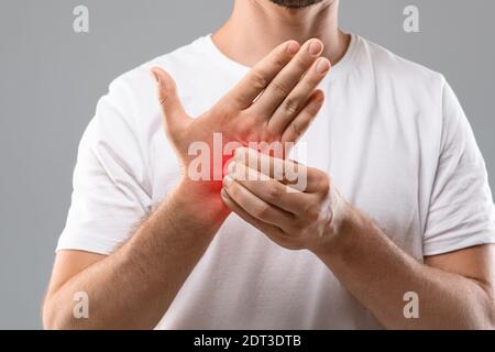 Nicht erkennbarer Mann kratzt Juckreiz an seiner Hand Stockfoto