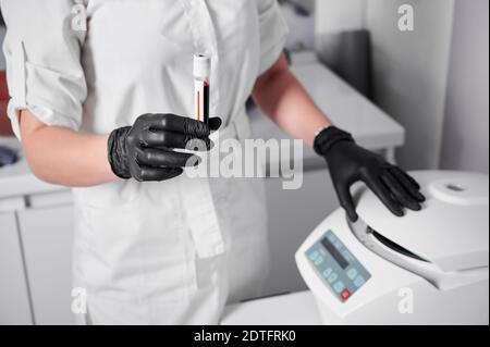 Plasmolifting-Prozess. Vorbereitung des Blutes für Injektionen. Kosmetologe in schwarzen Gummihandschuhen und weißen Uniform setzt Röhrchen mit Blut in die Zentrifuge. Konzept von Schönheit und Gesundheit Stockfoto