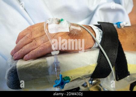 In der Hand eines operierten Patienten befindet sich die Venenkanüle Zur Infusion Stockfoto