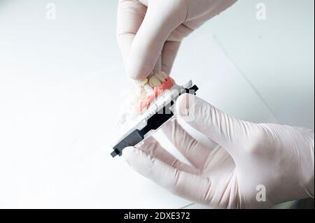 Nahaufnahme eines Arztes, der Zahnkrone und Prothese in der Klinik hält Stockfoto