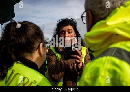 FRA - GILETS JAUNES DE DINAN Samedi 26 Janvier, sur le QG des Gilets Jaunes de Dinan en Bretagne, maquillage pour dénoncer les violences policières. F Stockfoto