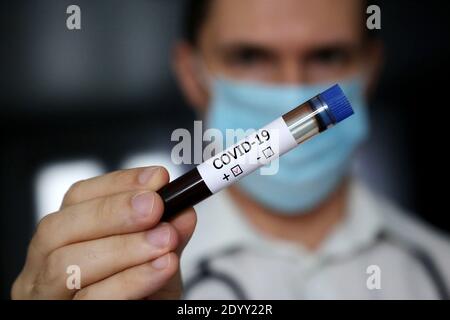 Reagenzglas mit Covid-19 Blutprobe in der männlichen Hand Nahaufnahme. Arzt oder Wissenschaftler mit positivem Coronavirus-Test Stockfoto