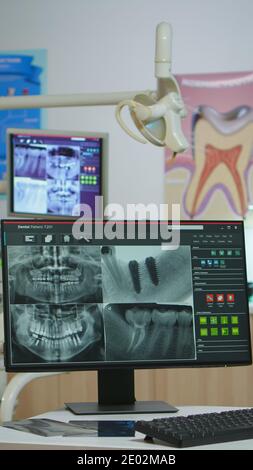 Interior of modern dentistry medical room with special stomatologial equipment. Stomatology clinic with nobody in prepared for next patient with radiograph displayed on computer screen Stockfoto