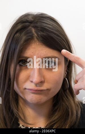 Ein isoliertes Porträt einer jungen Frau mit Problemhaut und Pickel auf ihrer Stirn. Problemhaut-Konzept. Stockfoto