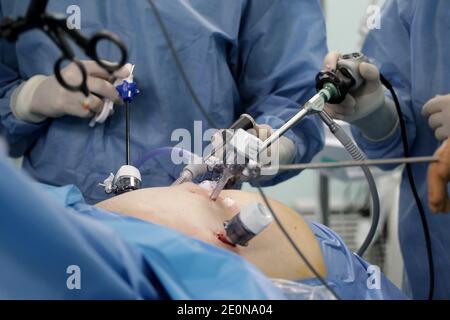 Roboter-assistierte Chirurgie, Griechenland Stockfoto