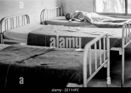 Ein kleines Kind mit HIV/AIDS in einem Krankenhaus in Malawi, Afrika. Fotografiert im Jahr 1991. Stockfoto