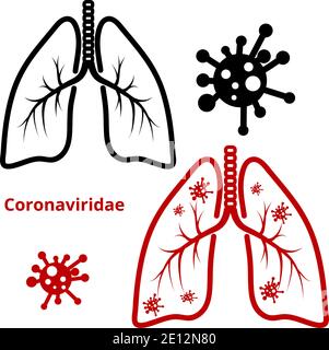 Coronavirus, eine Virusinfektion in der menschlichen Lunge. Bild der Lunge einer Person mit einem Virus auf einem weißen isolierten Hintergrund. Vektorgrafik Stock Vektor