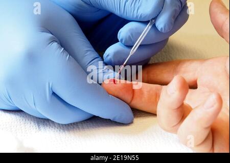 Italien, Toskana Region, Arezzo, 12. Mai 2020 : Coronavirus Notfall, San Giuseppe Krankenhaus, serologische Test im Labor für Covid-19 Krankheit Phot Stockfoto